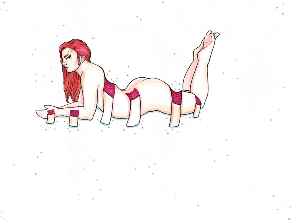 color drawing of a woman with skin grafts exposing her insides